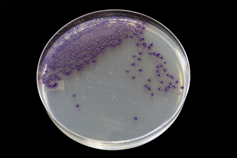 close-up, growing, laboratory, agar, petri, biochemistry, indoors, petri dish, colonies, environmental, germs, magnification, fungi, dish, samples, science