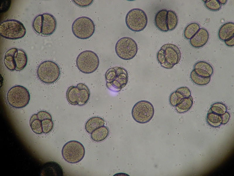 1080P, science, embryo, water, analysis, sea urchin, indoors, cells biology, magnification, microscopic, glass - material, experiment, life, close-up