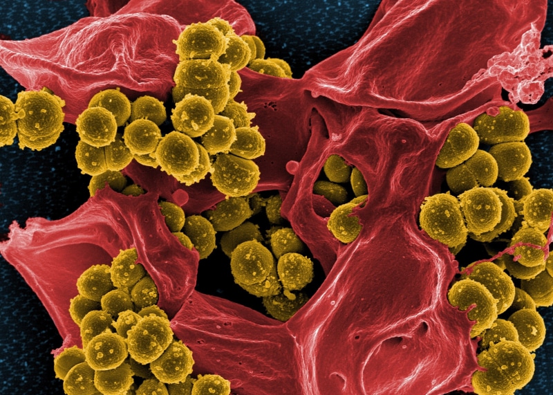 illness, green, indoors, medical condition, virus, medicine, methicillin resistant, microscopic, blood, electron microscope, photograph, biochemistry, no people