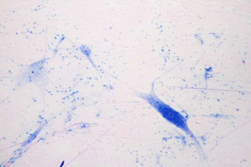 indoors, body, nervous, nature, art and craft, axon, medicine, creativity, nerve, water, medical, no people, big, multipolar, neuron, full frame, structure