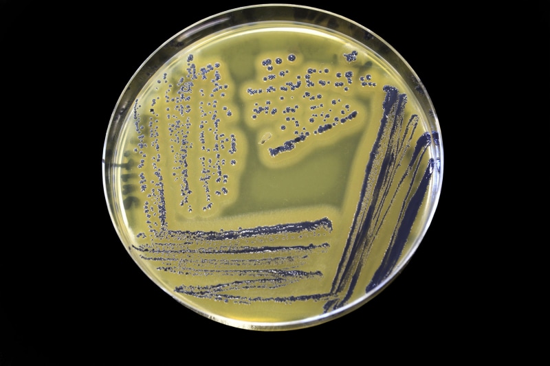 egg, yolk, parker, staphylococcus, university, bubble, fungi, air, pathogen, microbiology, studio shot, samples, close-up, disease, presumptive identification