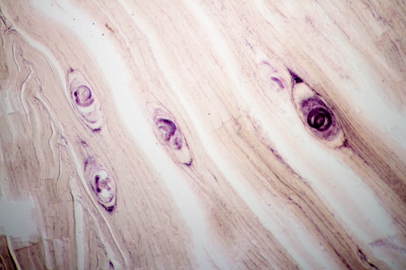 veterinary, human, muscle, healthy, history, medicine, pork, photomicrograph, education, backgrounds, cycle, zoology, abstract, food, pig, no people, life