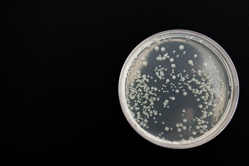 biology, directly above, experiment, studio shot, refreshment, laboratory, white, microbiology, food, infection, dna, science, bubble, bacteria, indoors
