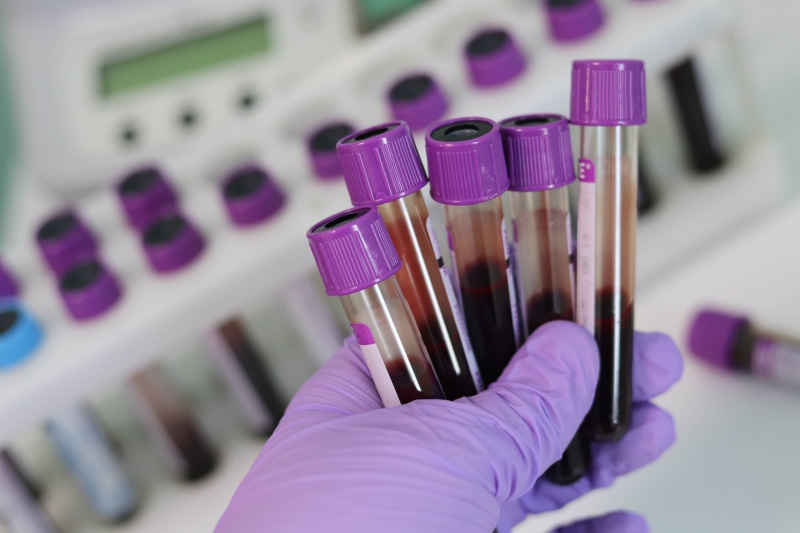 medical research, laboratory, research, scientific experiment, blood samples, medicine, analyzing, hand, tube, test tube rack, 5K, scientist, close-up