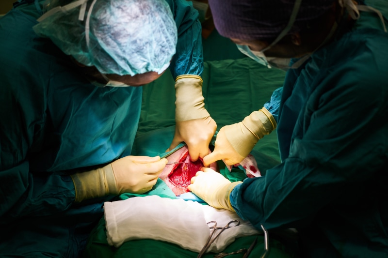 care, blood, surgeon, expert, operating room, scrubs, occupation, medical equipment, hygiene, medical procedure, emergency room, nurse, life, healthcare worker