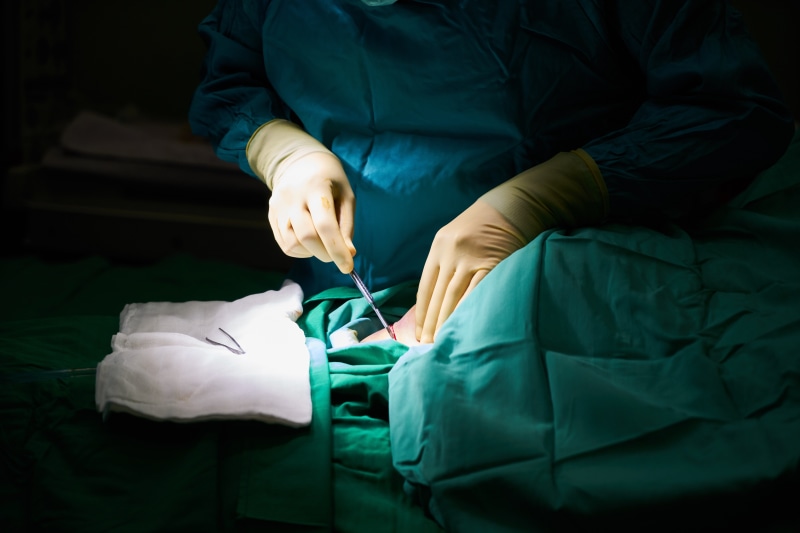 scalpel, surgical glove, medical procedure, teamwork, the work, human hand, expert, equipment, expertise, 5K, mask, surgical equipment, emergency, green