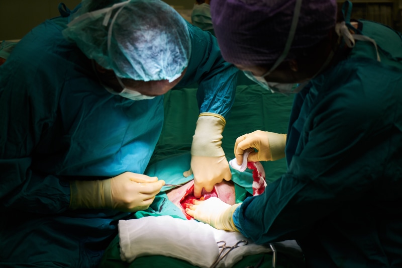surgery, birth, anesthesia, surgical glove, scissors, operation, operating room, new born, photo, medical exam, emergency, healthcare worker, scrubs, teamwork
