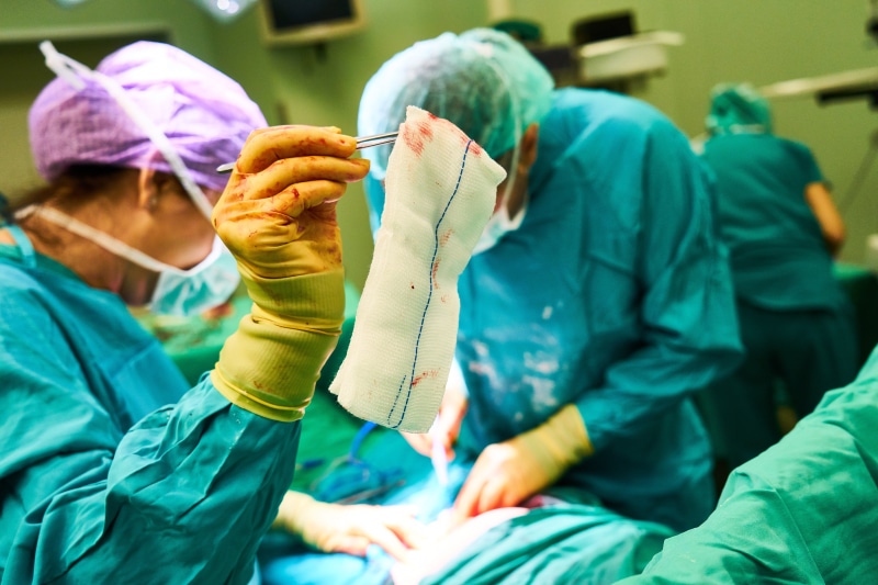 death, medical exam, doctor, anesthesia, adult, 8K, surgical glove, expert, modern, medicine, teamwork, scrubs, surgical equipment, dressing, healthcare and medicine
