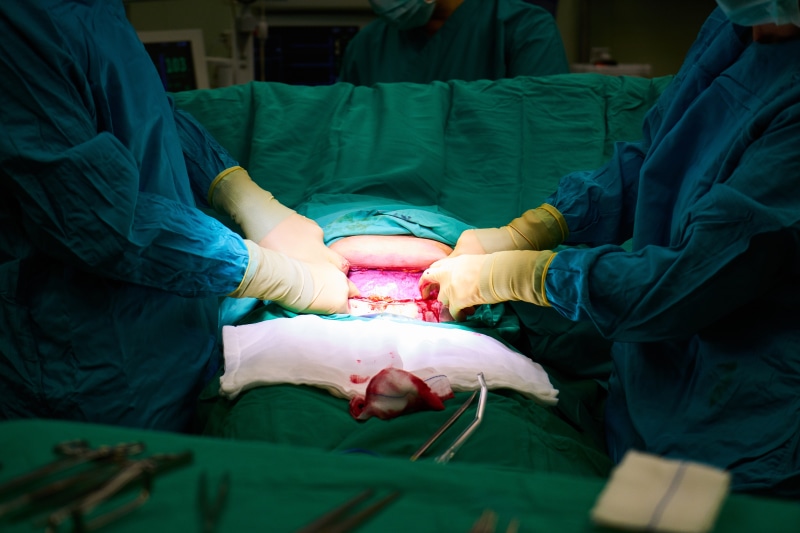 baby, operation, expertise, life, occupation, scissors, adult, new born, breed, scalpel, birth, medicine, teamwork, healthcare worker, childhood, protection