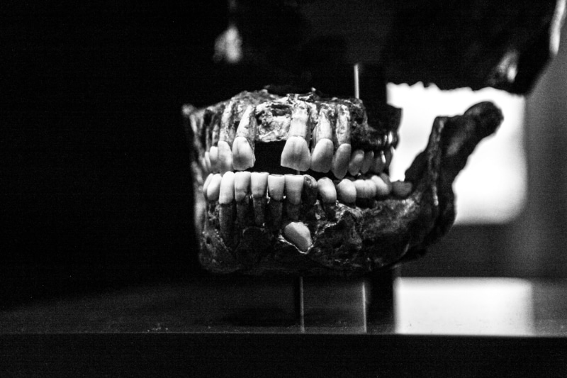 Skull, glass - material, 4K, healthcare and medicine, burning, care, dentist, teeth, old, dental, Old, indoors, mouth, still life, focus on foreground
