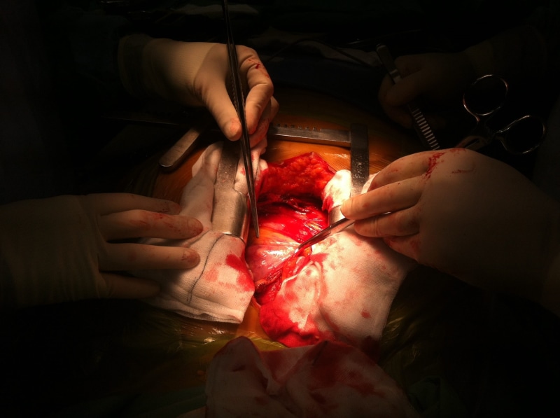 heart, health, responsibility, Operation, human, hospital, body part, surgical equipment, Surgery, open, 2K, science, medical procedure, operate, human body part
