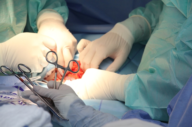 surgical glove, s, occupation, disease, two people, equipment, healthcare, surgeon, nurse, working, medical equipment, people, hospital, real people, sterile