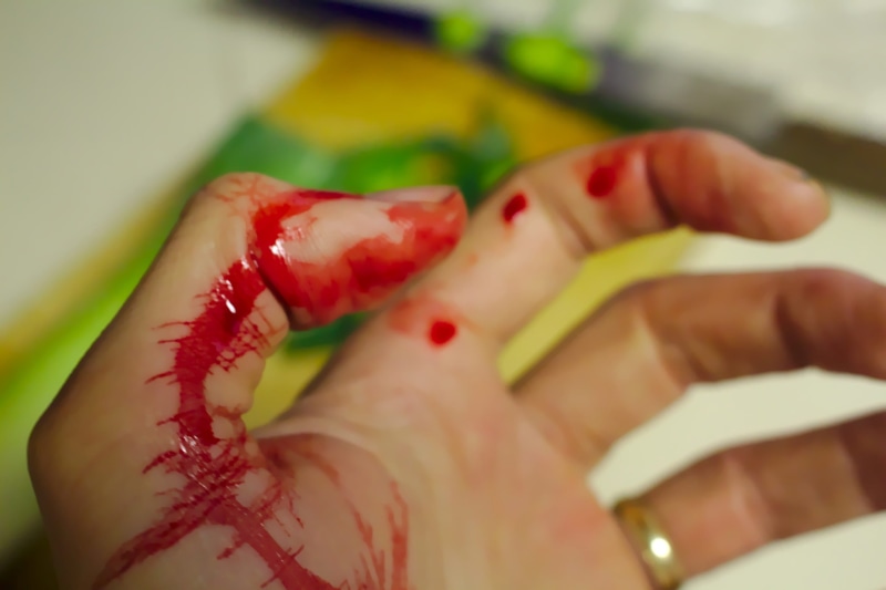 red, chopping, bleed, human hand, food and drink, healthcare and medicine, emergency, one person, pain, health-care, bleeding finger, human body part, body part