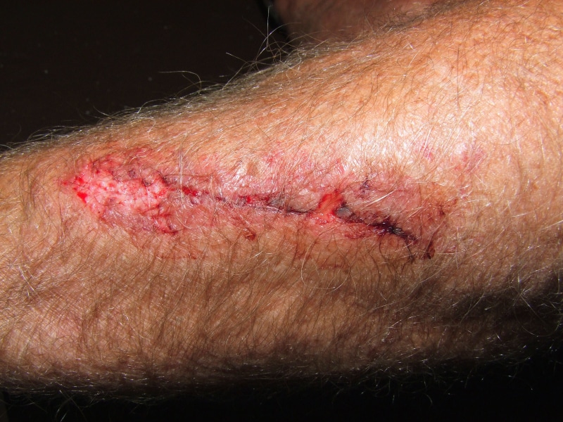 aggression, adult, close-up, one person, real people, Injury, bruise, physical injury, human body part, indoors, Patient, Wound, Pain, human hair, unrecognizable person