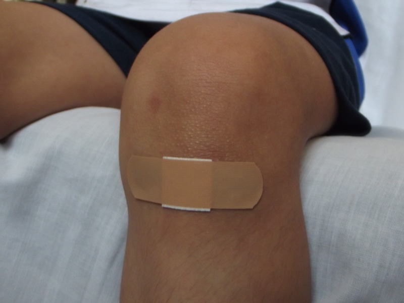 one person, shorts, human limb, midsection, girl, pain, indoors, human knee, close-up, baby, limb, wounded, patient, human body part, wound, injured, bandage