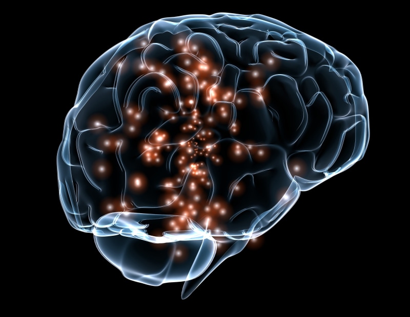 depression - sadness, illuminated, complexity, ray, healthcare and medicine, Anatomy, cut out, human brain, science, contemplation, technology, d, head