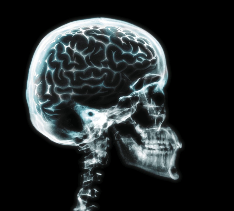 three dimensional, people, human skull, d, medical exam, brain, medical x-ray, black background, profile view, mri scan, human face, XRAY, human brain