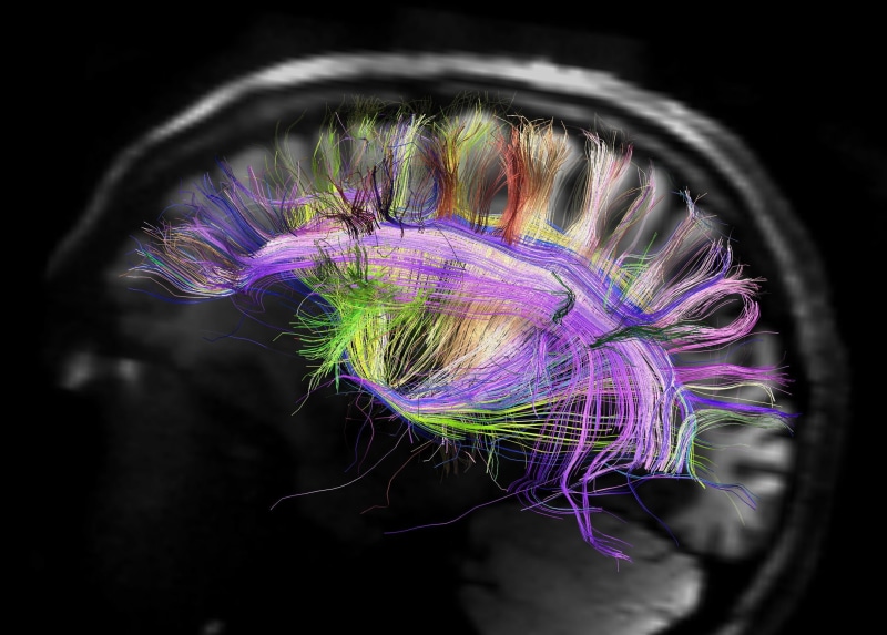 XRAY, brain, Medical, skull, head, Anatomy, digital, x, psychedelic, 3, ray, 1080P, d