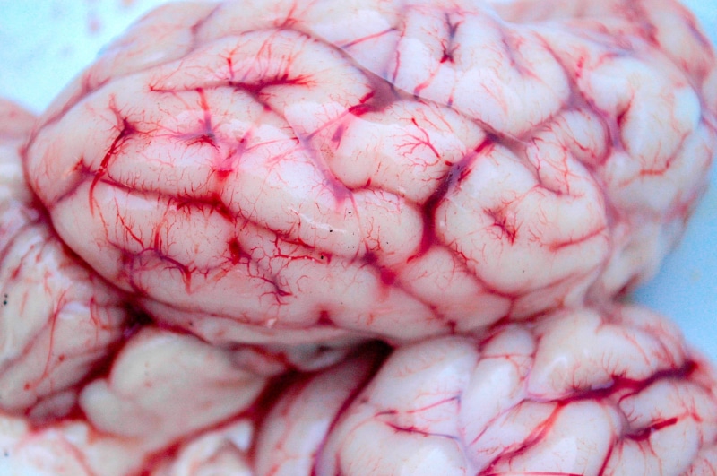 indoors, 2K, virus, human, focus, bacterium, blood, biology, icon, human body part, nerve, pink color, science, thinking, mental, healthcare and medicine