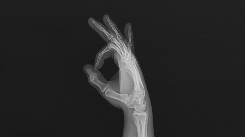 hands, 1080P, x-rays, fingers, bones