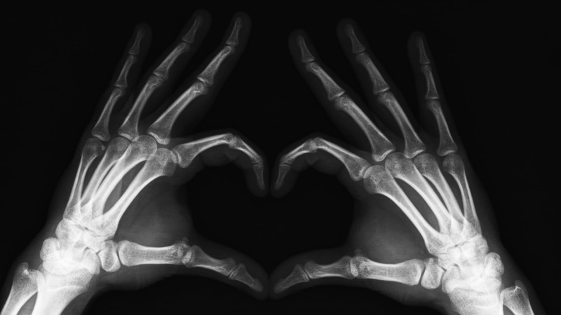 healthcare And Medicine, medical x-ray, human limb, close-up, black Color, human finger, diagnostic medical tool, hand, finger, limb, x, pair, human joint