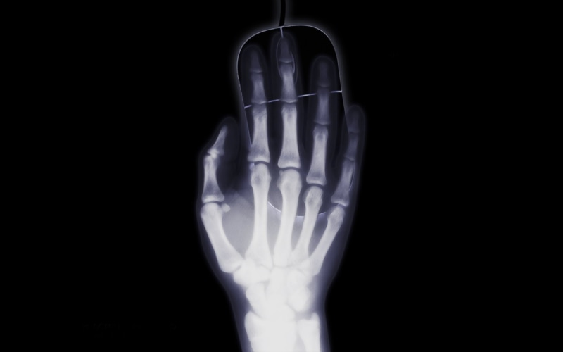 Black, Humor, illustration, Bones, Mouse, Hand, 1080P, Minimalist, human, x, X-Ray, Photography, ray