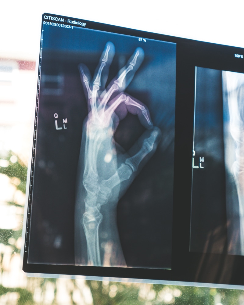 electronics, skeleton, medical, brisbane city, human hand, human body part, xray, obscured face, unrecognizable person, arm, laptop, touch screen, human bone