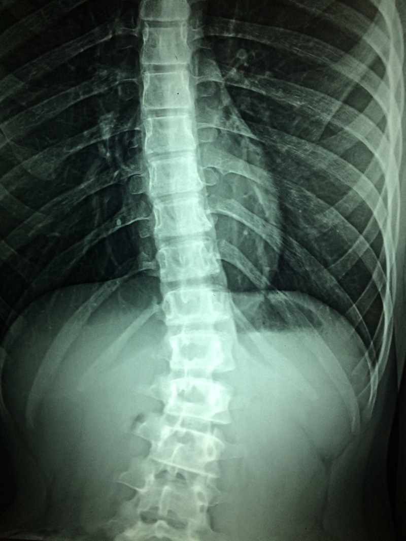 anatomy, x-ray image, medical exam, fracture, body part, healthcare, human skeleton, human limb, patient, medical procedure, illness, Disability, radiograph