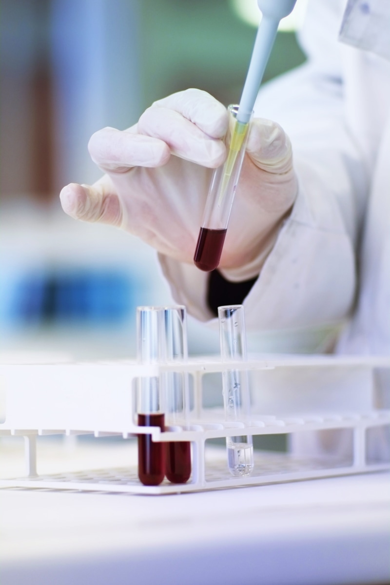 tube, finger, 4K, glass, transfer, laboratory, test tube rack, chemistry, focus on foreground, biologist, human hand, hand, biology, education, doctor