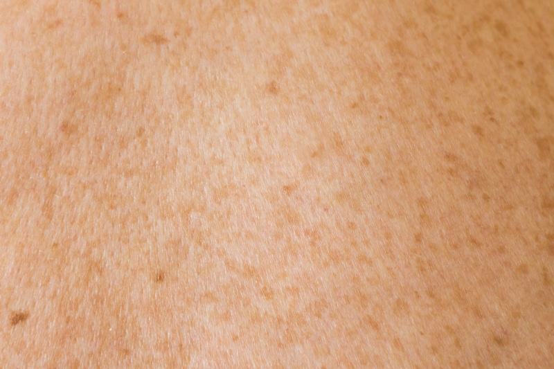 rough, natural pattern, freckles, mole, 4K, textured effect, clean, wood - material, wood grain, no people, beige, abstract, copy space, human skin, pattern