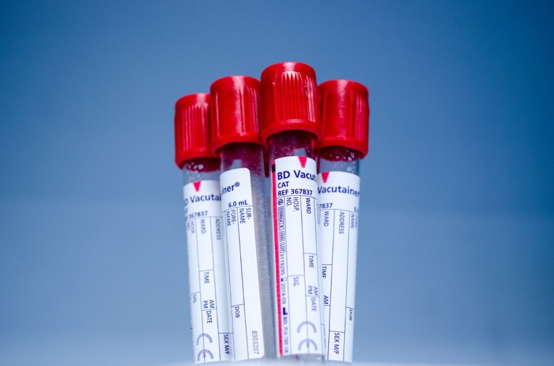 emotion, thermometer, research, medical, studio shot, nature, close-up, white color, red, technology, label, clear sky, bd, lab, exam, sky, hospital, group
