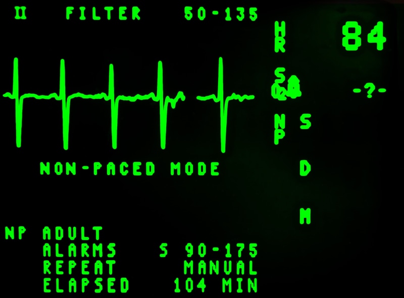 data, beat, close-up, technology, frequency, cardiology, display, control panel, medicine, communication, rate, graph, led, finance, pulse, reading, digital display