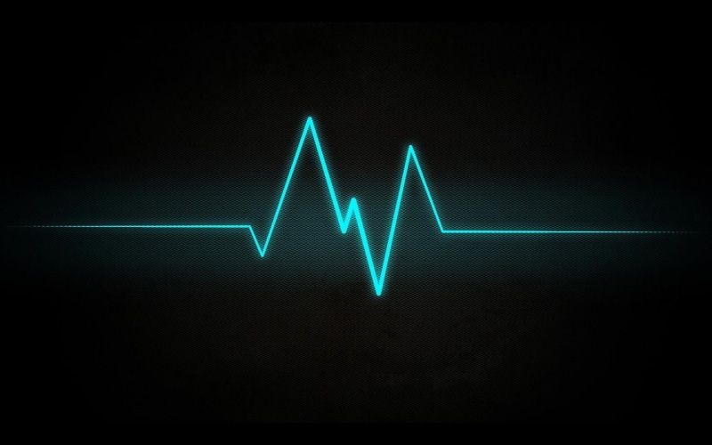 1080P, ekg