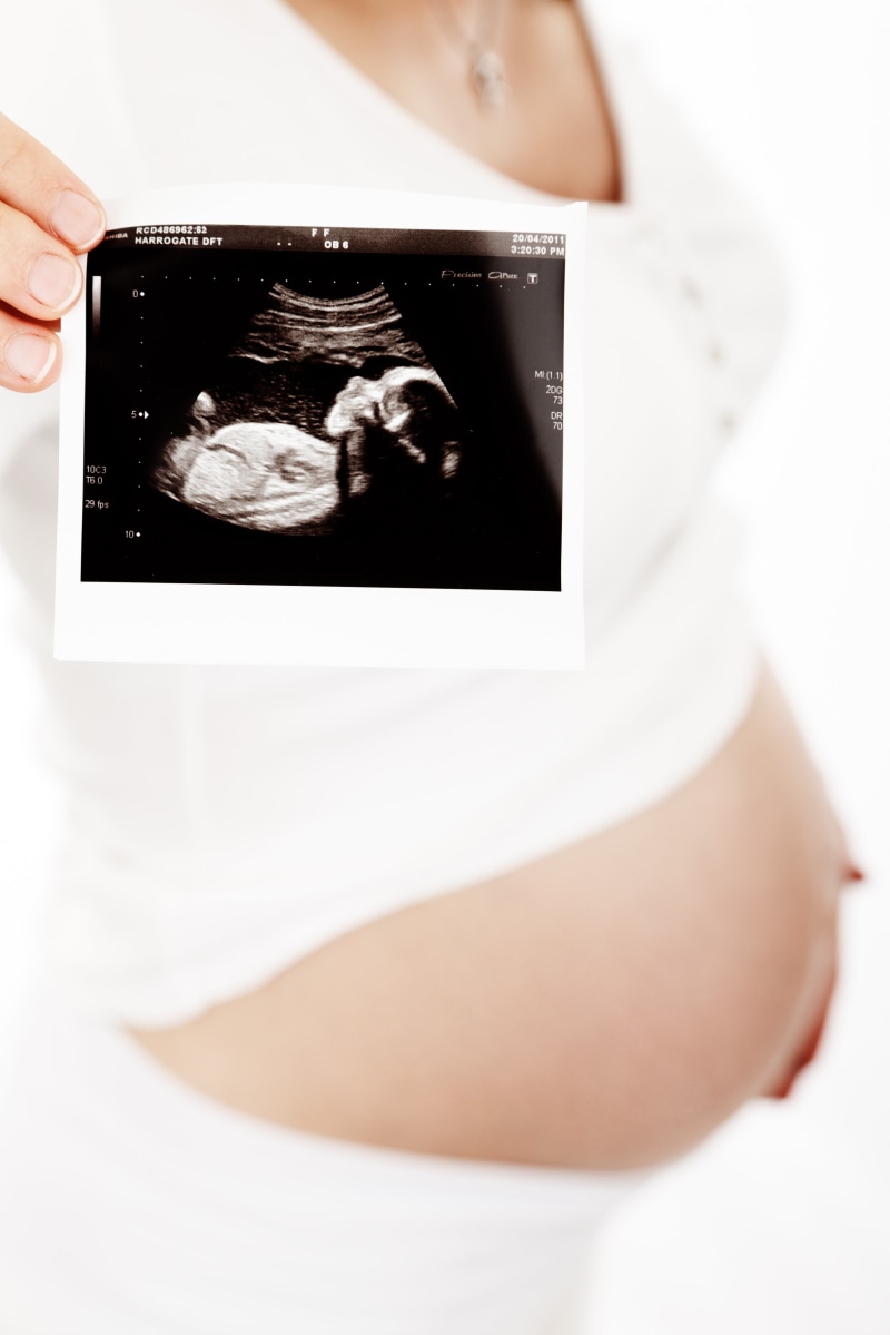 person, people, beginnings, adult, ultrasound, photography themes, paper, white background, tummy, female, parent, young women, belly, human abdomen, maternity
