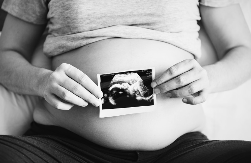 happiness, black and white, abdomen, mum, female, body part, belly, close-up, people, new life, human abdomen, healthcare, woman, stomach, mother, adult