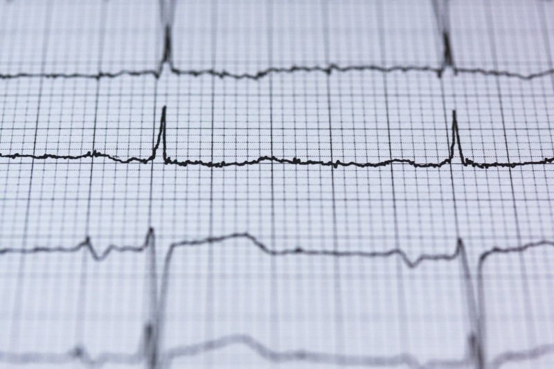 technology, rhythm, result, close-up, diagram, ecg, no people, frequency, grid, heartbeat, medical, line graph, health check, horizontal, blur, trading