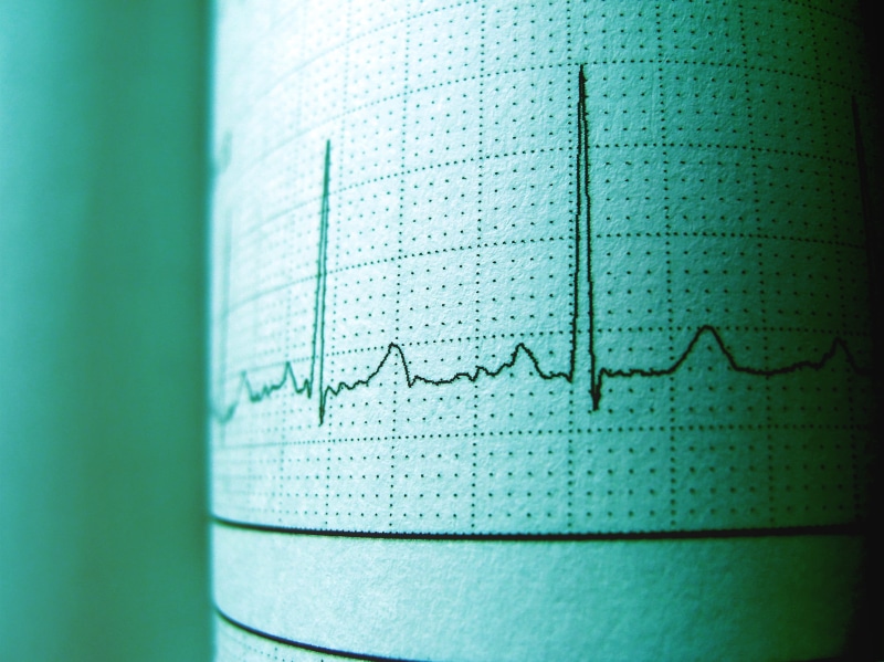 cardiogram, technology, healthcare and medicine, research, selective focus, analyzing, scientific experiment, medicine, ecg, rhythm, education, care, science