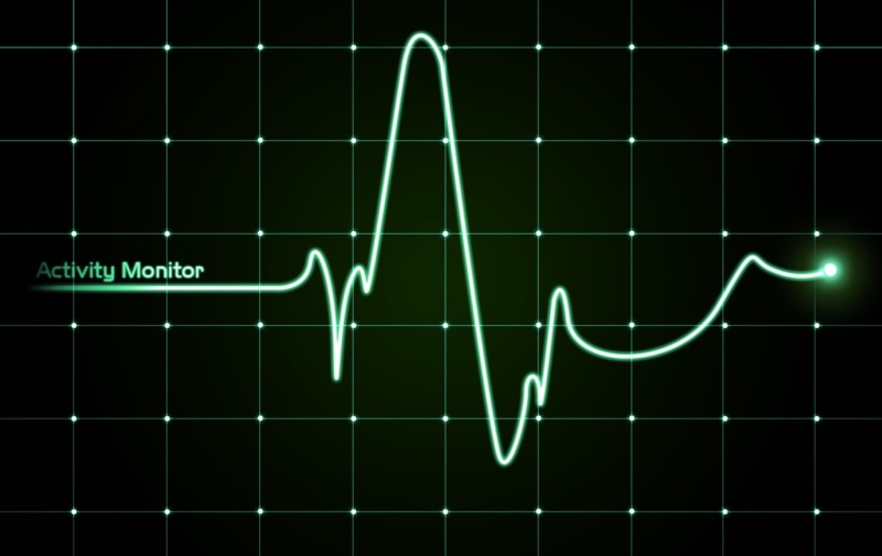 glowing, heartbeat, taking Pulse, diagram, activity, green, backgrounds, blue, illuminated, wave pattern, medical Exam, vector, illustration, line, monitor