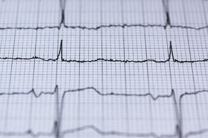 no people, check up, finance, medical, rhythm, diagram, heartbeat, frequency, healthcare, trading, pulse, close-up, health, health check, horizontal, nature
