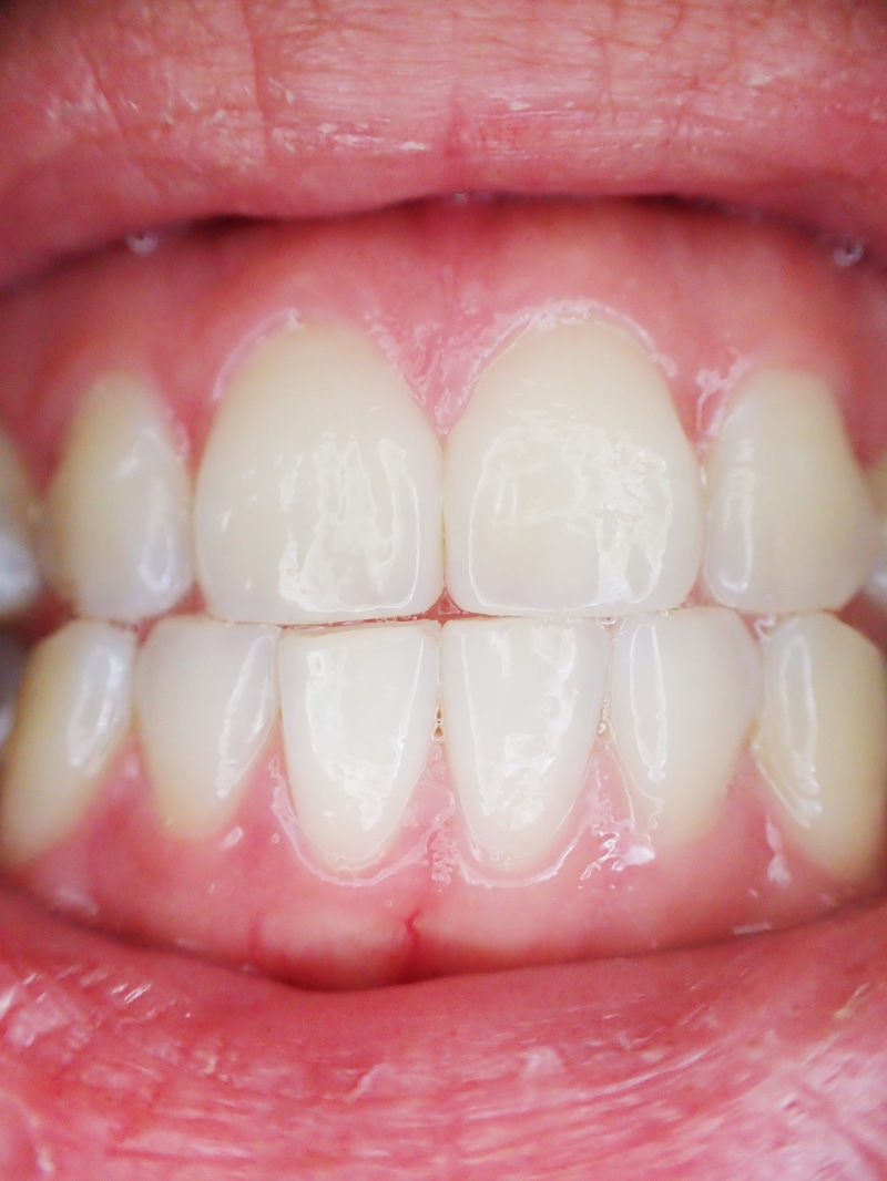 indoors, lips, tooth, human Mouth, mouth, human hand, human Teeth, 4K, s, red, human body part, extreme close-up, dental health, body part, full frame