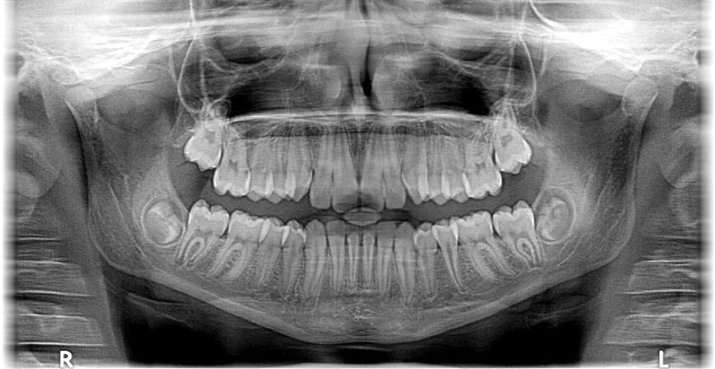 roentgen, human body part, the doctor, indoors, emotion, tooth, teeth, photo, x-ray, one person, occlusion, digital composite, every now and, representation