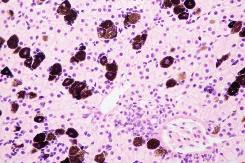 purple, research, endoplasmic reticulum, study, light, Binucleate, anatomy, full frame, stained, no people, university, education, tissue, fixed, nuclei