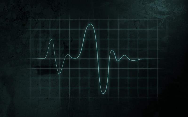 instrument of measurement, black color, grid, healthcare And Medicine, taking Pulse, creativity, data, medicine, graph, design, finance, shadow, teal, glowing