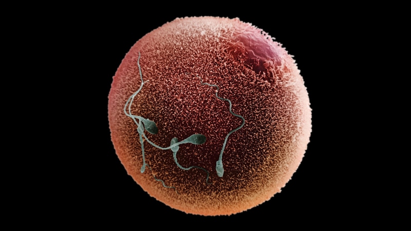 Sexual, nature, men, abstract, indoors, single object, microbiology, Male, biology, no people, DNA, healthcare and medicine, research, close-up, 2K, cut out
