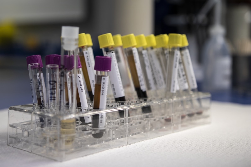 tube, diagnostician, biochemistry, medical test, medical, tests, group of objects, indoors, chemistry, close-up, 2K, test tube, test tube rack, education