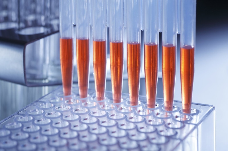 science, medical research, bokek, Biology, Cylinder, abstract, research, close-up, glass, test tube rack, Vials, indoors, 720P, tubes, equipment, biotechnology