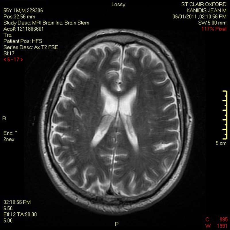 x-ray image, biology, scan, healthcare and medicine, hospital, medical exam, medical x-ray, magnetic, technology, illness, no people, resonance, human brain