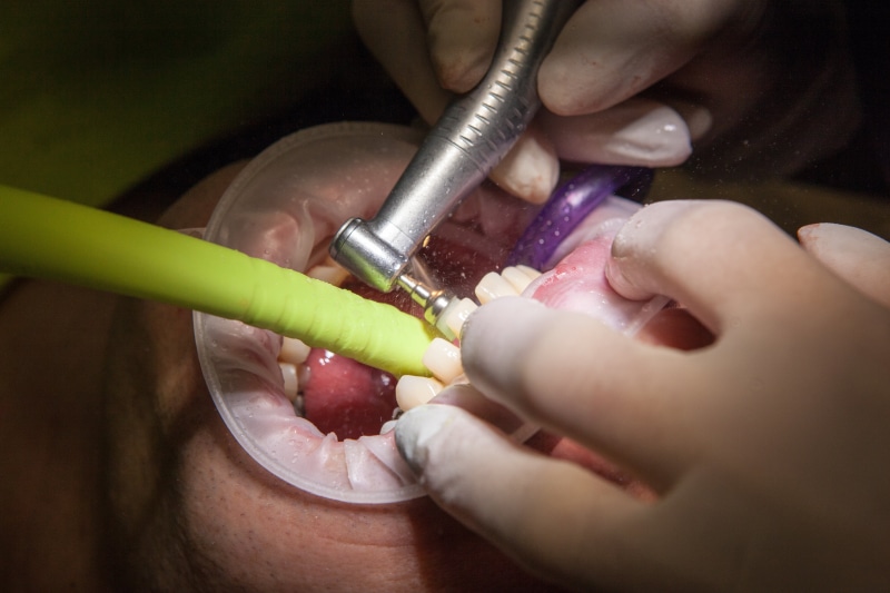 hand, body part, human mouth, 5K, mouth open, oral, food and drink, dentist, teeth, cleaning, close-up, health, dental equipment, human teeth, human hand