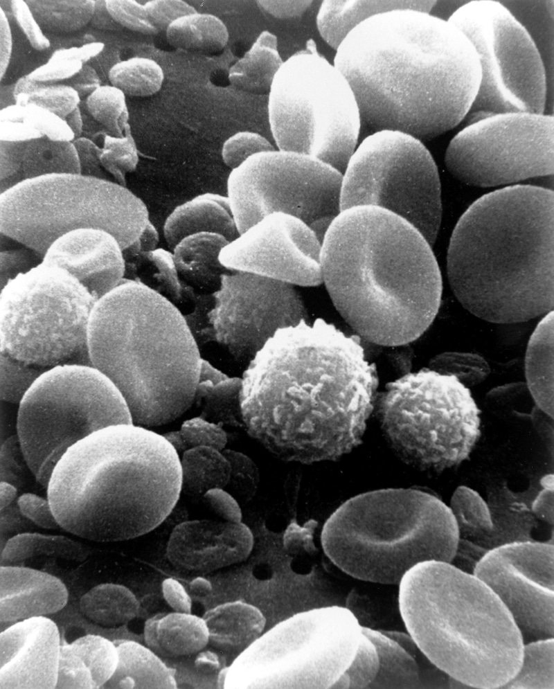human, invertebrate, water, no people, underwater, science, sea, electron microscope, growth, medicine, full frame, large group of objects, cells, marine