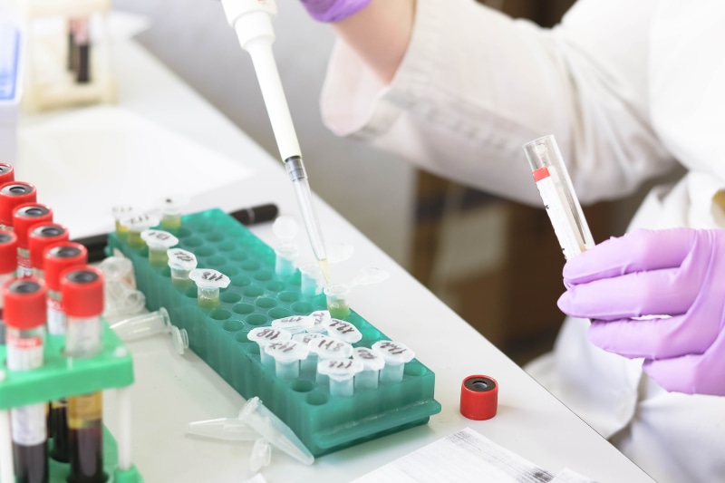 lab coat, blood samples, occupation, woman, human hand, working, research, laboratory equipment, chemistry, biology, education, experiment, medical, tube